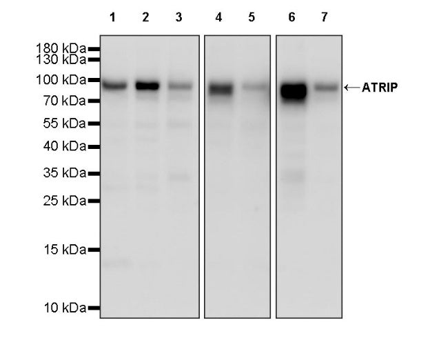 ATRIP Recombinant Rabbit mAb (S-1275-48)