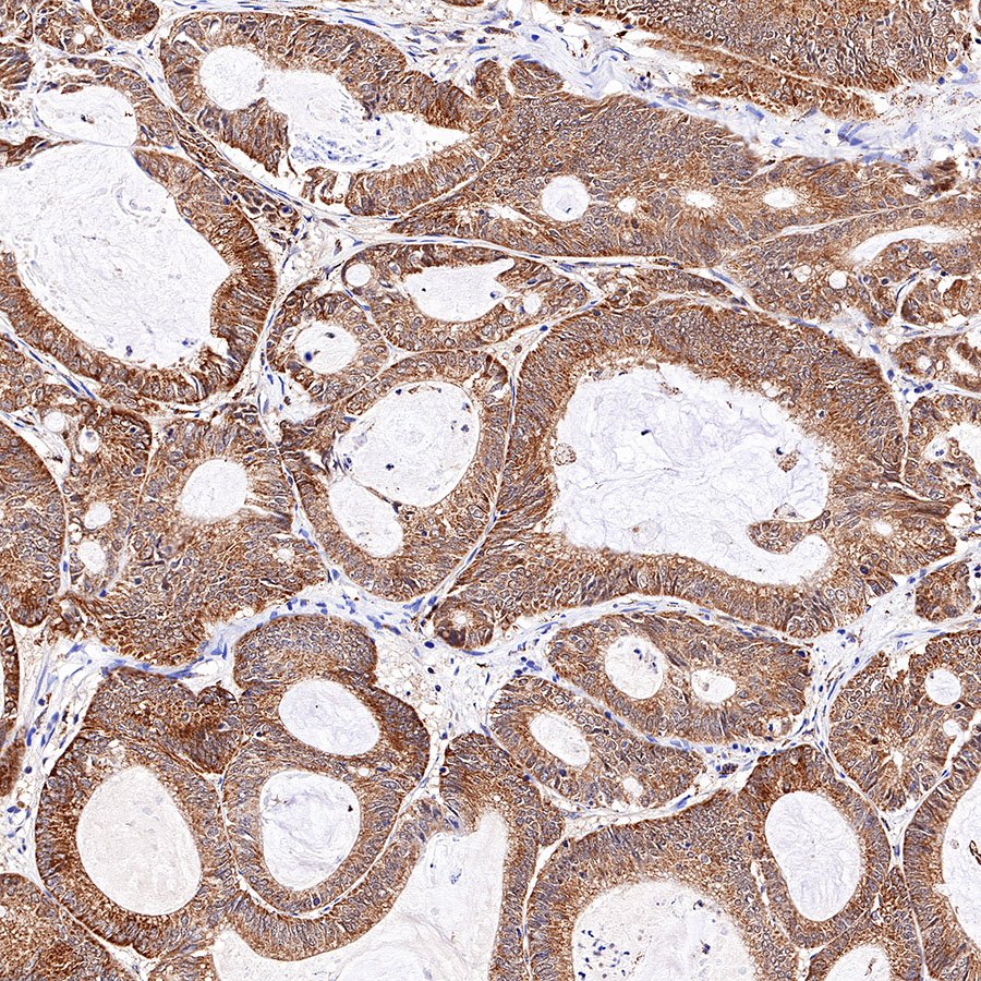 S-RMab® Stat6 Recombinant Rabbit mAb (SDT-337-32)