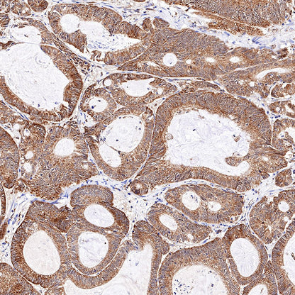 S-RMab® Stat6 Recombinant Rabbit mAb (SDT-337-32)