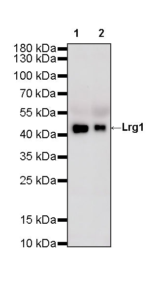 Lrg1 Recombinant Rabbit mAb (S-4084-27)
