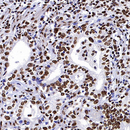 Histone H3 (di+tri methyl K79) Recombinant Rabbit mAb (S-854-48)