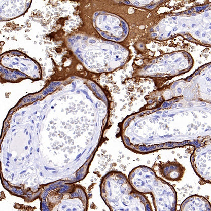 ALPG Rabbit Polyclonal Antibody