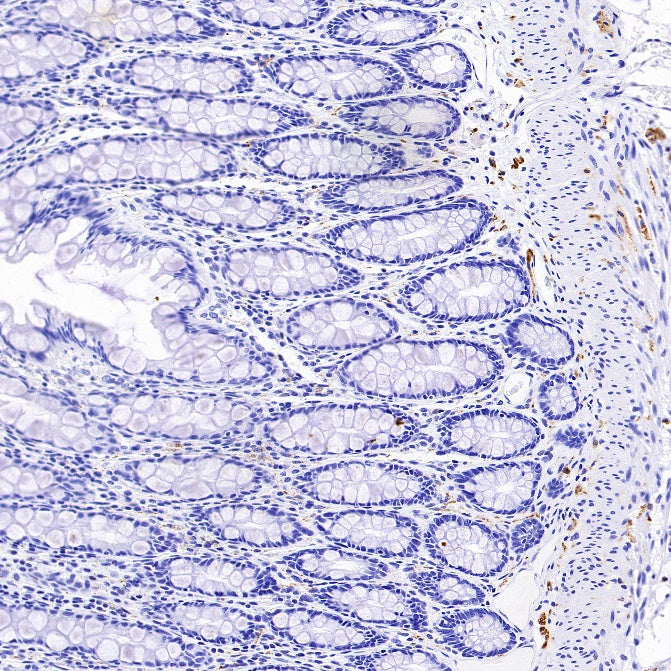 Anti-Rabbit and Mouse HRP-DAB IHC Secondary Antibody (2-step)
