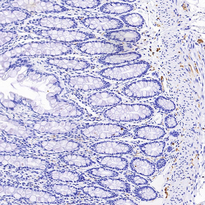 Anti-Rabbit and Mouse HRP-DAB IHC Secondary Antibody (2-step)