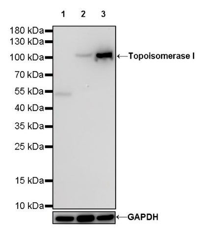 S-RMab®Topoisomerase I Recombinant Rabbit mAb (S-R209)