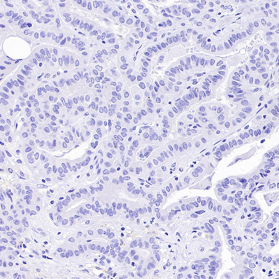 PAM Recombinant Rabbit mAb (SDT-2995-30)