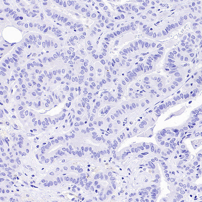 PAM Recombinant Rabbit mAb (SDT-2995-30)