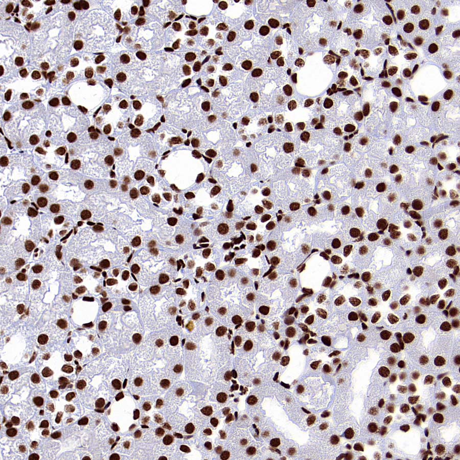 SMC1 Recombinant Rabbit mAb (S-4147-54)