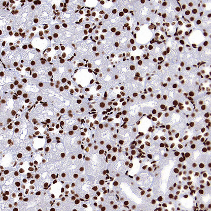 SMC1 Recombinant Rabbit mAb (S-4147-54)