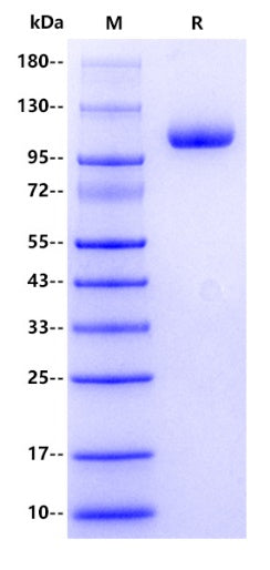 Human Factor H/CFH (19-866aa) Protein, His Tag