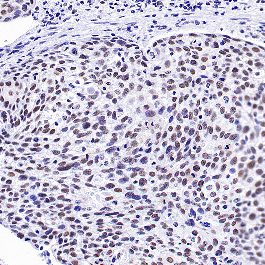 INI-1/SMARCB1 Recombinant Rabbit mAb (S-4068-21)