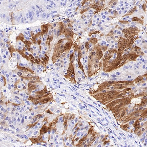 CDKN2A/p16 INK4A Recombinant Mouse mAb (SDT-4675)