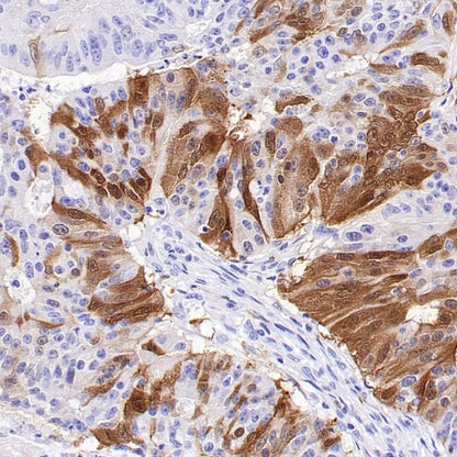 CDKN2A/p16 INK4A Recombinant Mouse mAb (SDT-4675)