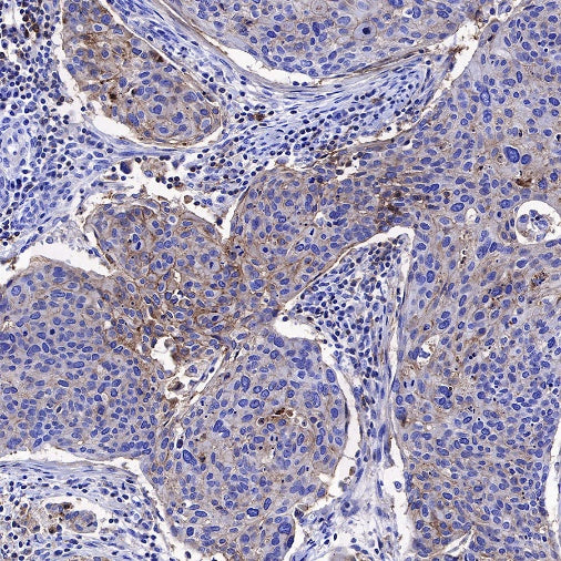 CD82 Recombinant Rabbit mAb (S-673-44)
