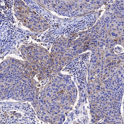 CD82 Recombinant Rabbit mAb (S-673-44)