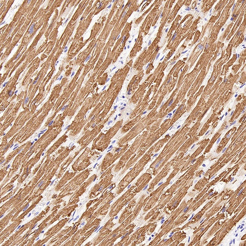 MYH7 Recombinant Rabbit mAb ,PBS Only (SDT-2936-44)