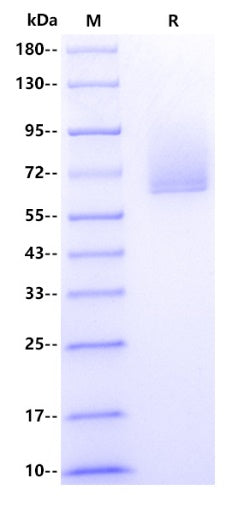 Human TGOLN2/TGN46 Protein, His Tag