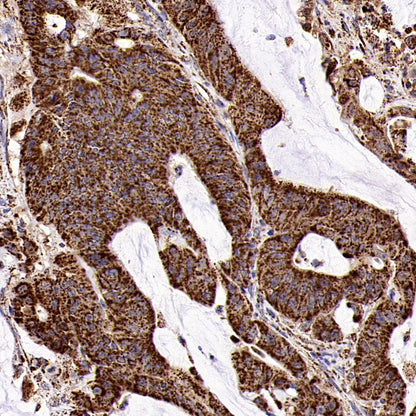 Fumarate hydratase Recombinant Rabbit mAb (SDT-2434-54)