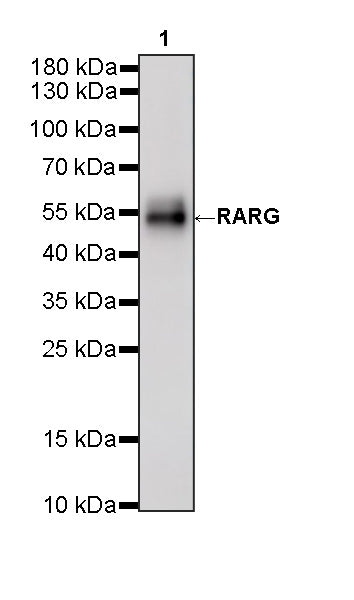 RARG Recombinant Rabbit mAb (S-4448-23)