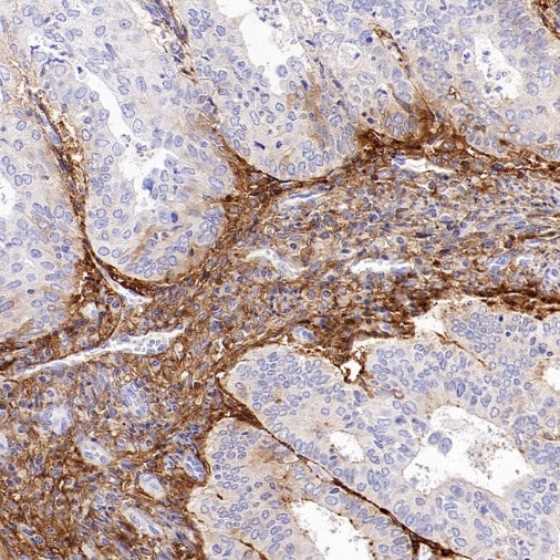 Versican Recombinant Rabbit mAb (S-3770-43)