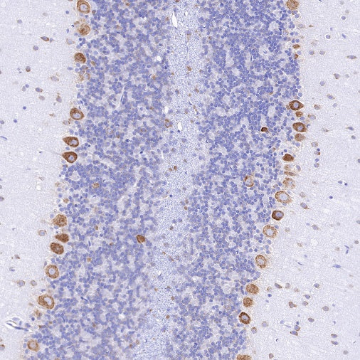 S6 Ribosomal Protein Recombinant Rabbit mAb (S-479-1)