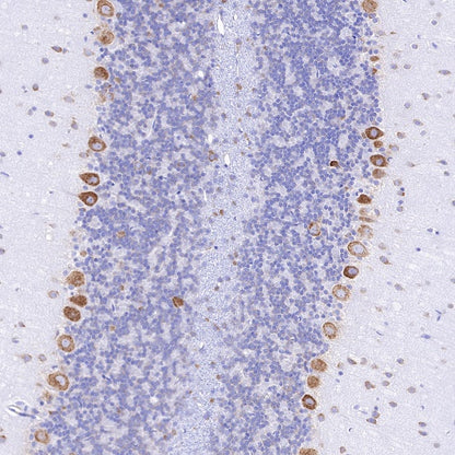 S6 Ribosomal Protein Recombinant Rabbit mAb (S-479-1)