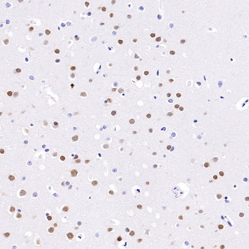 HuD/ELAVL4 Recombinant Rabbit mAb (S-1351-159)