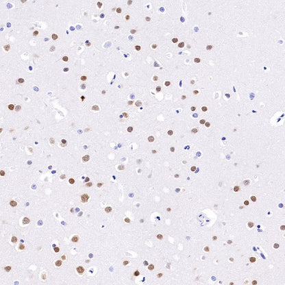 HuD/ELAVL4 Recombinant Rabbit mAb (S-1351-159)