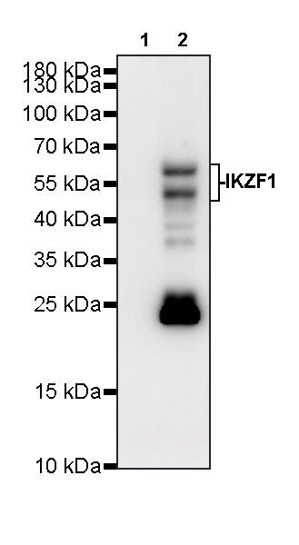 IKZF1 Recombinant Rabbit mAb (S-4176-17)