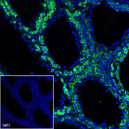 DAZL Recombinant Rabbit mAb (S-1552-6)