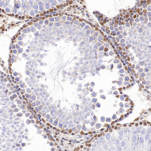 KDM6A Recombinant Rabbit mAb (S-1728-51)