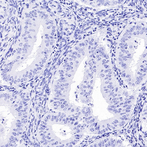 AKAP4 Recombinant Rabbit mAb (SDT-4196)