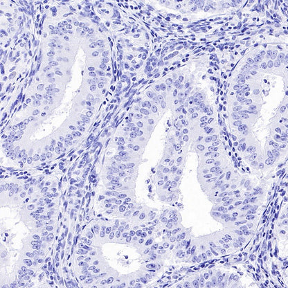 AKAP4 Recombinant Rabbit mAb (SDT-4196)