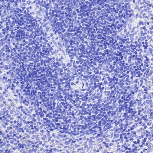 Mouse mAb IgG2a, κ Isotype Control (S-844-17)