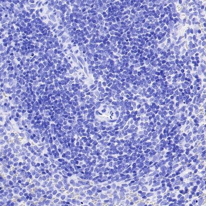 Mouse mAb IgG2a, κ Isotype Control (S-844-17)