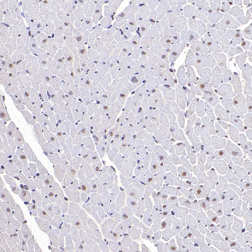 DNA Ligase IV/LIG4 Recombinant Rabbit mAb (S-2237-64)