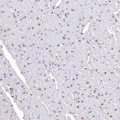 DNA Ligase IV/LIG4 Recombinant Rabbit mAb (S-2237-64)