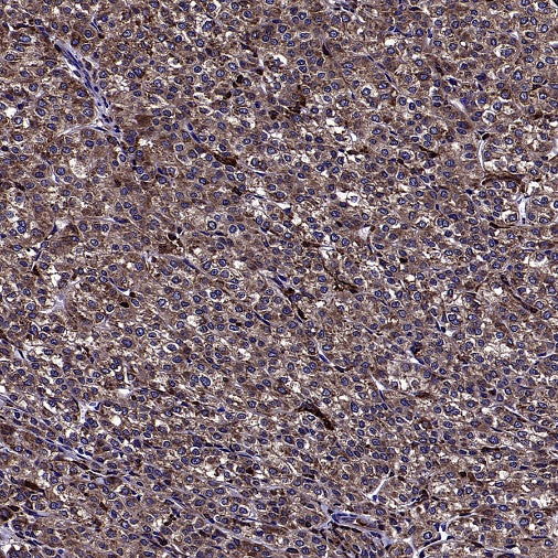AGTR1 Recombinant Rabbit mAb (S-2447-22)