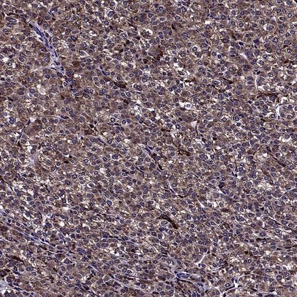 AGTR1 Recombinant Rabbit mAb (S-2447-22)