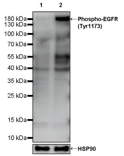 Phospho-EGFR (Tyr1173) Recombinant Rabbit mAb (S-1187-106)