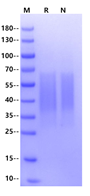 IL-18BP His Tag Protein, Cynomolgus