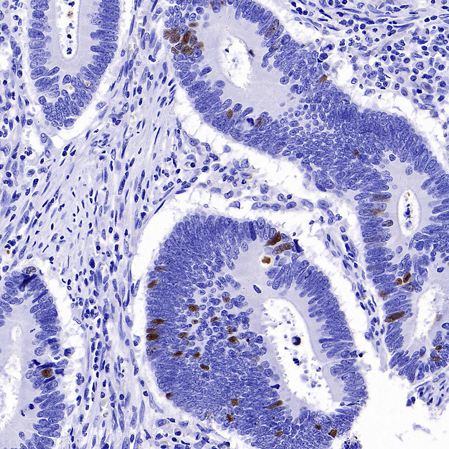 Phospho-DNA-PKcs (Ser2056) Recombinant Rabbit mAb (S-3813)
