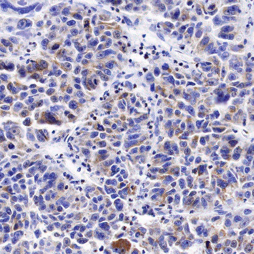 IDH2 Recombinant Rabbit mAb (S-1525-5)