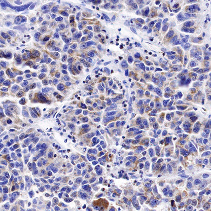 IDH2 Recombinant Rabbit mAb (S-1525-5)