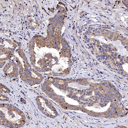 SQLE Recombinant Rabbit mAb (S-2358-207)