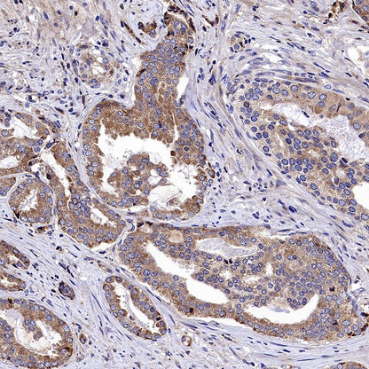 SQLE Recombinant Rabbit mAb (S-2358-207)