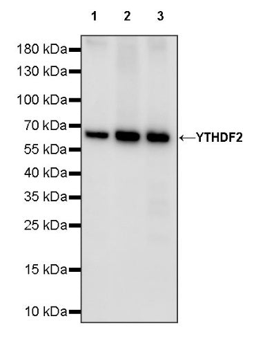 YTHDF2 Recombinant Rabbit mAb (S-1569-42)