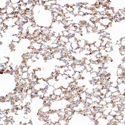 P4HB Recombinant Rabbit mAb
