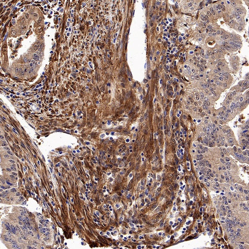 Vinculin Recombinant Rabbit mAb (S-1635-3)