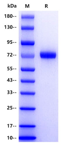 Human SLAMF3/LY9/CD229 Protein, His tag